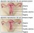 Semejanzas entre endometriosis y cáncer Semejanzas entre endometriosis y cáncer